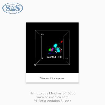 Jual-Mindray-BC-6800-Hematology-5-Diff---Sasmedica-(5)