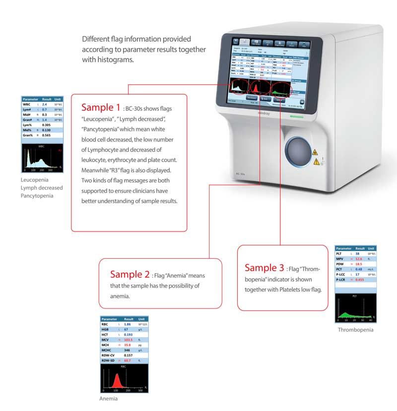 Mindray BC-30s Hematology Analyzer - Sasmedica